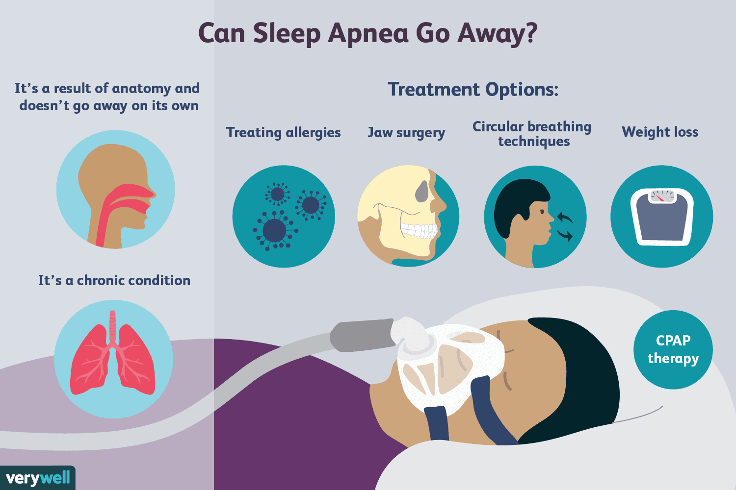 Can sleep apnea be cured by exercise?